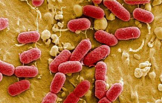 Background coliform bacteria باکتری های موجود در آب