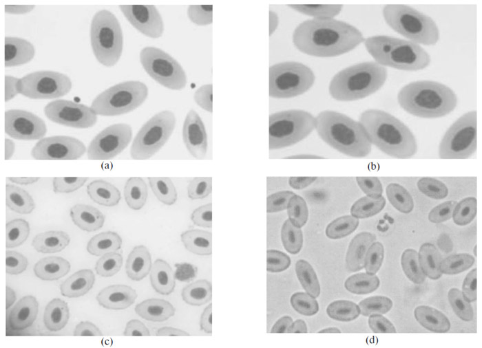 Comparative assessment of waters under study based on blood cells