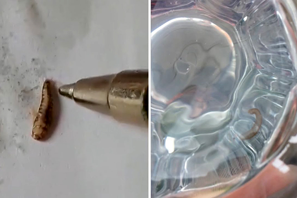 Parasites in water  انگل های موجود در آب