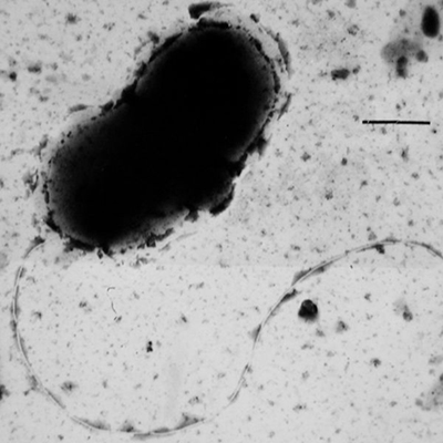 sulfate-reducing bacteria باکتری کاهش دهنده سولفات