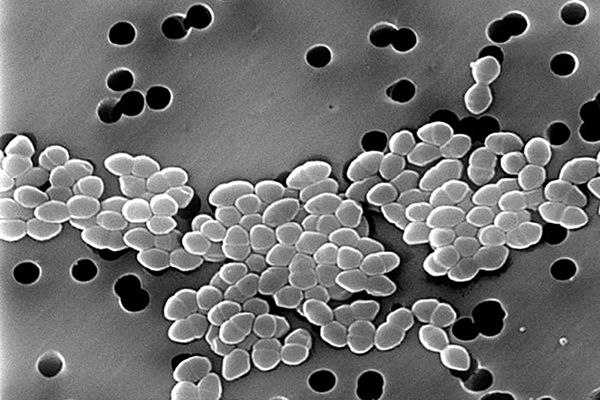 Vancomycin Resistant Enterococcus, باکتری انتروکوک مقاوم در برابر وانکومایسین،